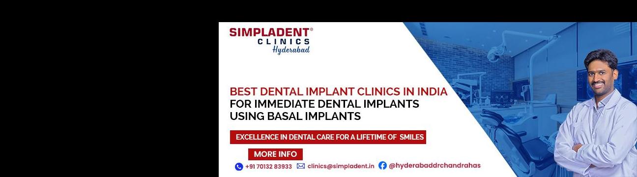 Dr. Chandrahas Bathini  Implantologist Hyderabad