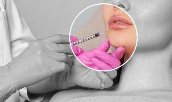 lip filler Barnsley
